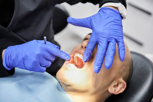 Best Emergency Broken Tooth Repair in King City, CA